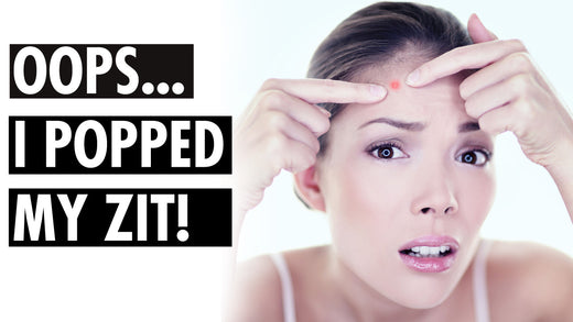Oops… I Popped My Zit!