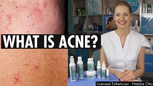 What is Acne?